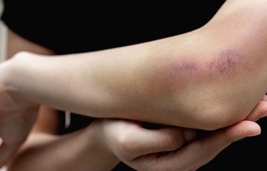 Awas, Ini Ciri Kerusakan Liver yang Muncul di Tangan dan Kaki