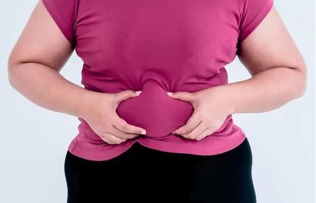 Obesitas Jadi Pintu Masuk Penyakit Kronis, Waspada... Waspada