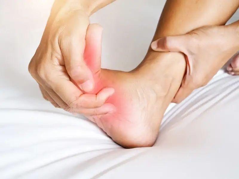 Waspada Jika Kaki Sering Kram, Ini Gejala dan Penyebabnya