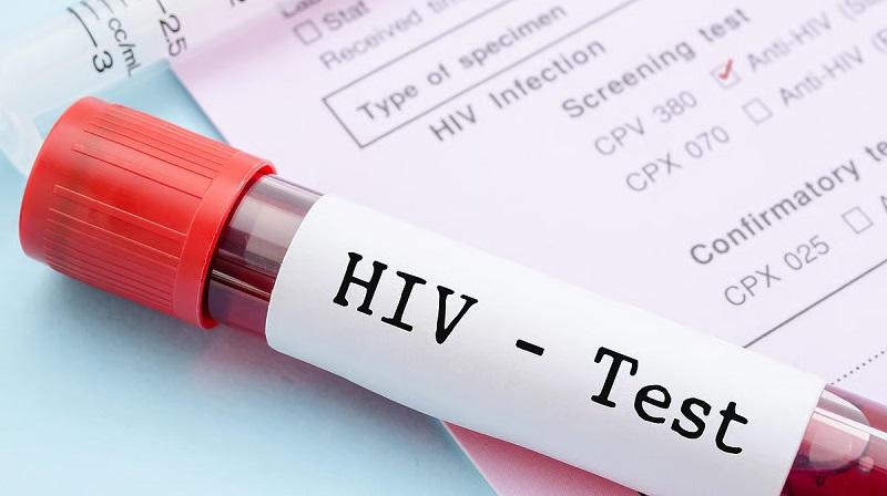 Waduh, Dinas Kesehatan Riau Temukan 11.336 Kasus HIV dan 6.990 Pasien Masih Bertahan