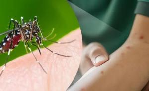 Pekanbaru Catat 578 Kasus DBD, Diskes Imbau Masyarakat Waspada