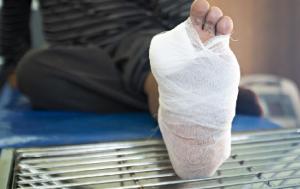 Komplikasi Diabetes Merembet ke Kaki Jadi Sasaran Utama? Ini Penjelasannya