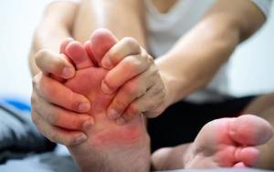 Ada 4 Tahapan Perkembangan Asam Urat, Ini Penyebab yang Perlu Diketahui